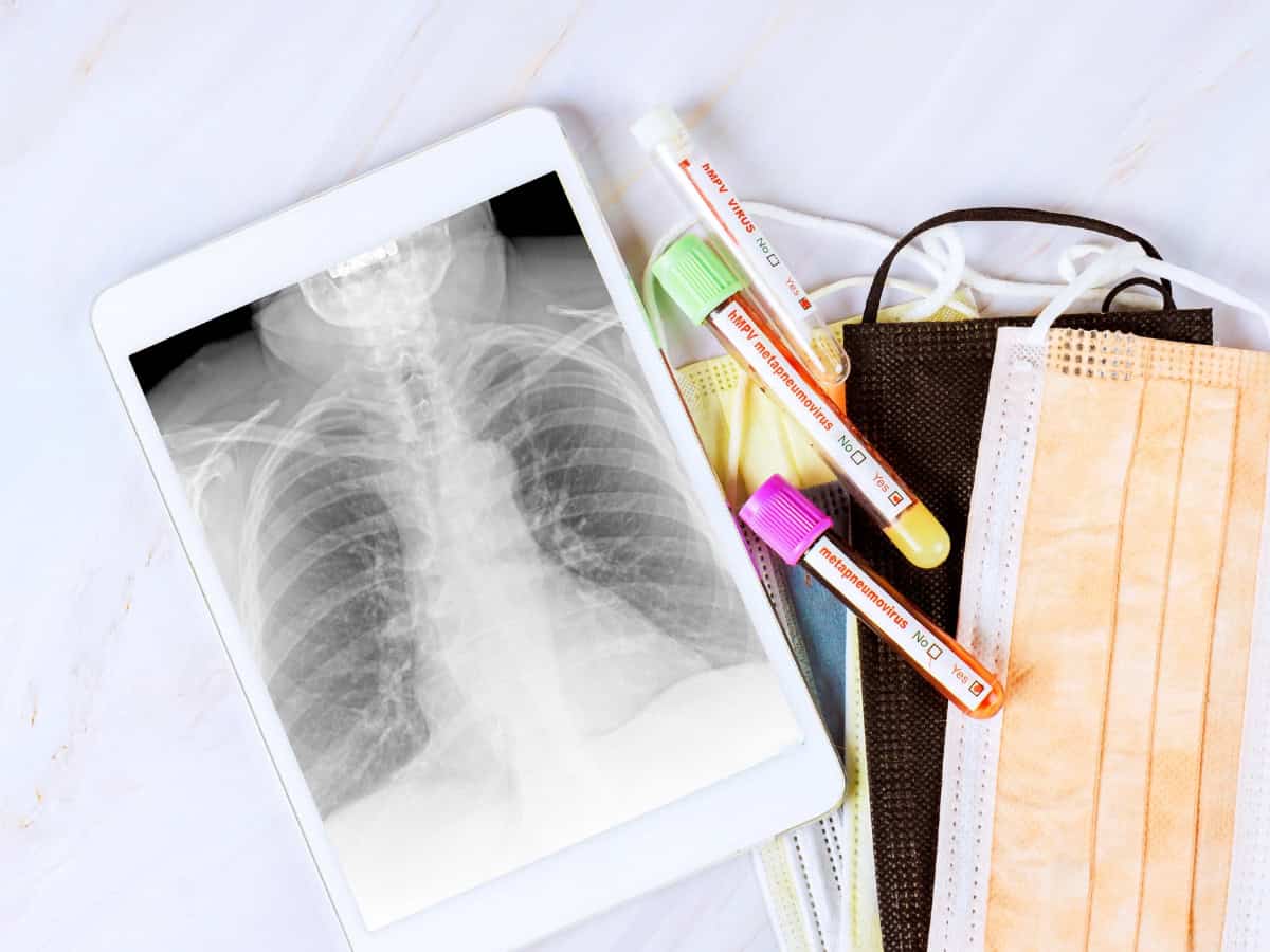 чести респираторни инфекции